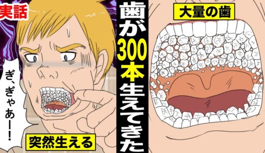 【実話】ある日突然、歯が300本生えてきた男。口の中に大量の歯が生えて男はどうなったのか？（マンガ動画）