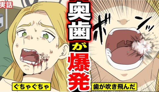 【漫画】口の中で奥歯が突然爆発して４本の歯が吹き飛んだ女…いったい何が原因だったのか・・・（マンガ動画）
